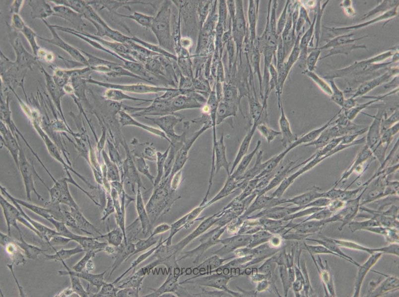 HFL1 (人胚肺成纤维细胞) (STR鉴定正确)