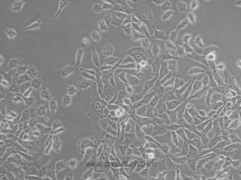 MDA-MB-415 (人乳腺癌细胞) (STR鉴定正确)