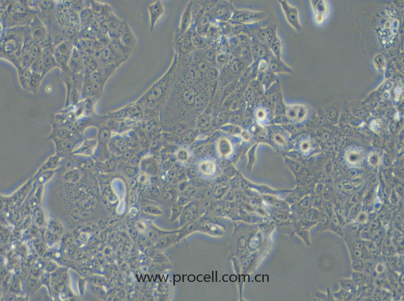 NCI-H441 (人肺腺癌细胞) (STR鉴定正确)