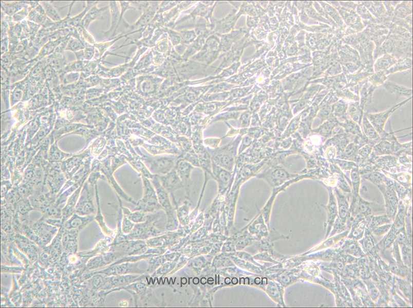 Hey (人卵巢癌细胞) (STR鉴定正确)