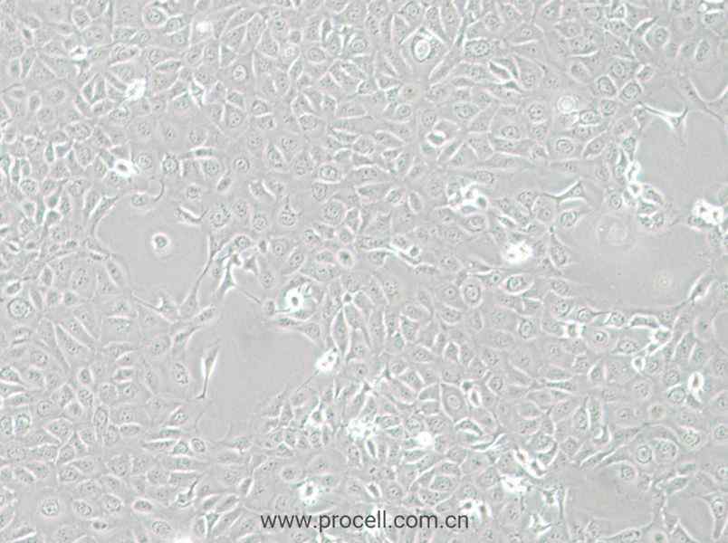 HCE-T (人角膜上皮细胞) (STR鉴定正确)