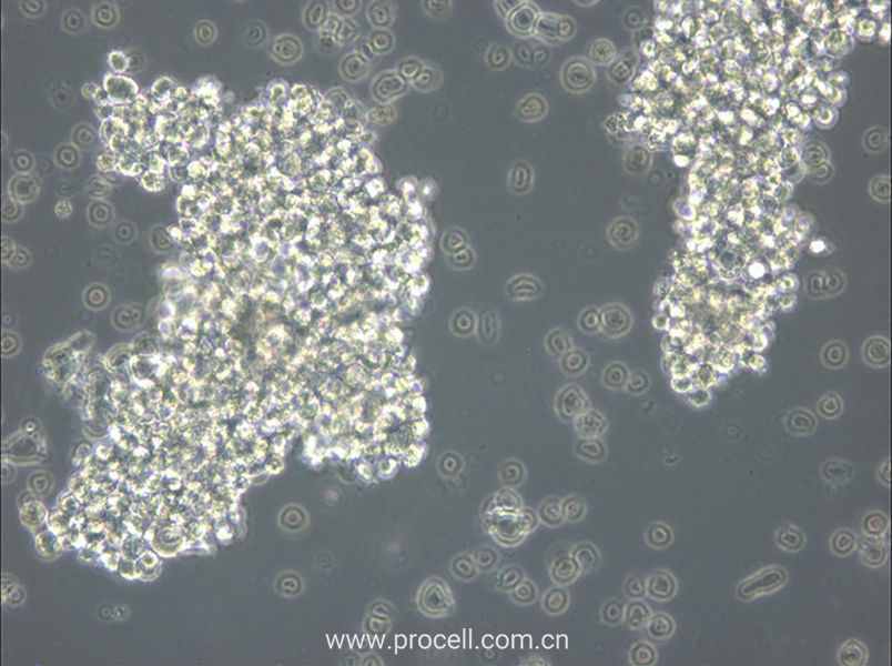 OCI-Ly3 (人弥漫大 B 细胞淋巴瘤细胞) (STR鉴定正确)