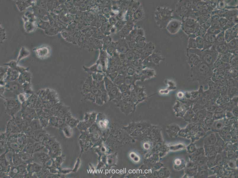 NCI-H1573 (人肺癌腺癌细胞) (STR鉴定正确)