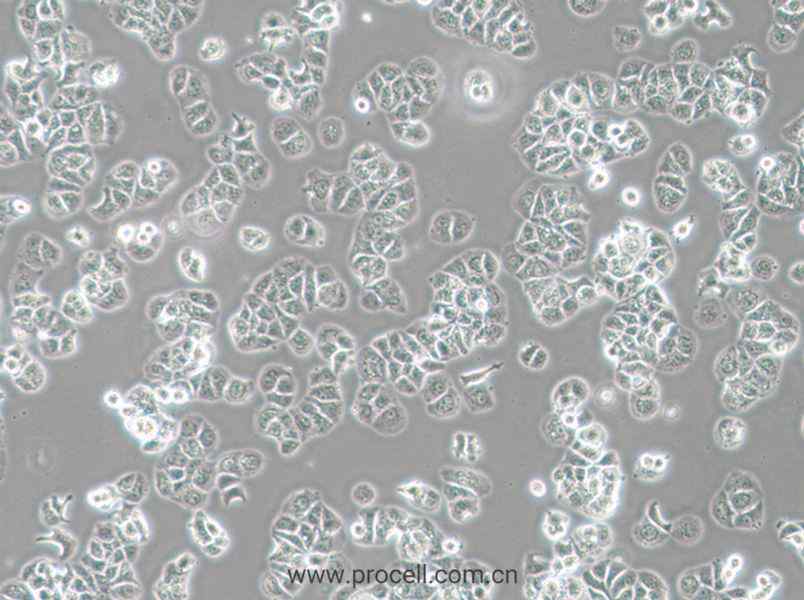 HCC1428 (人乳腺腺癌细胞) (STR鉴定正确)