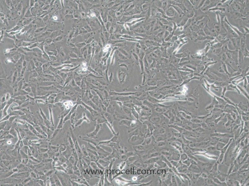 OCUT-2C (人甲状腺癌细胞（未分化）) (STR鉴定正确)