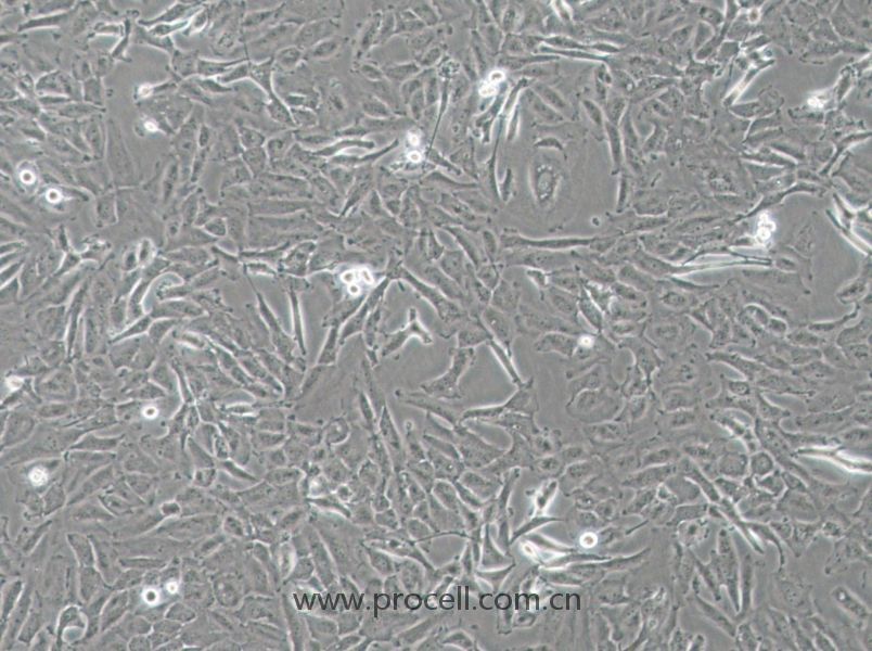 OCUT-2C (人甲状腺癌细胞（未分化）) (STR鉴定正确)