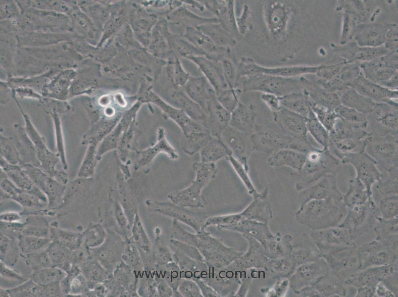 OCUT-2C (人甲状腺癌细胞（未分化）) (STR鉴定正确)