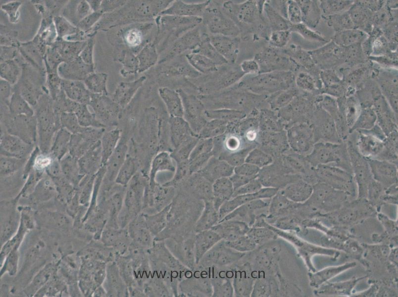 OCUT-2C (人甲状腺癌细胞（未分化）) (STR鉴定正确)