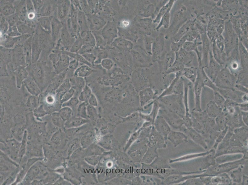 OCUT-2C (人甲状腺癌细胞（未分化）) (STR鉴定正确)