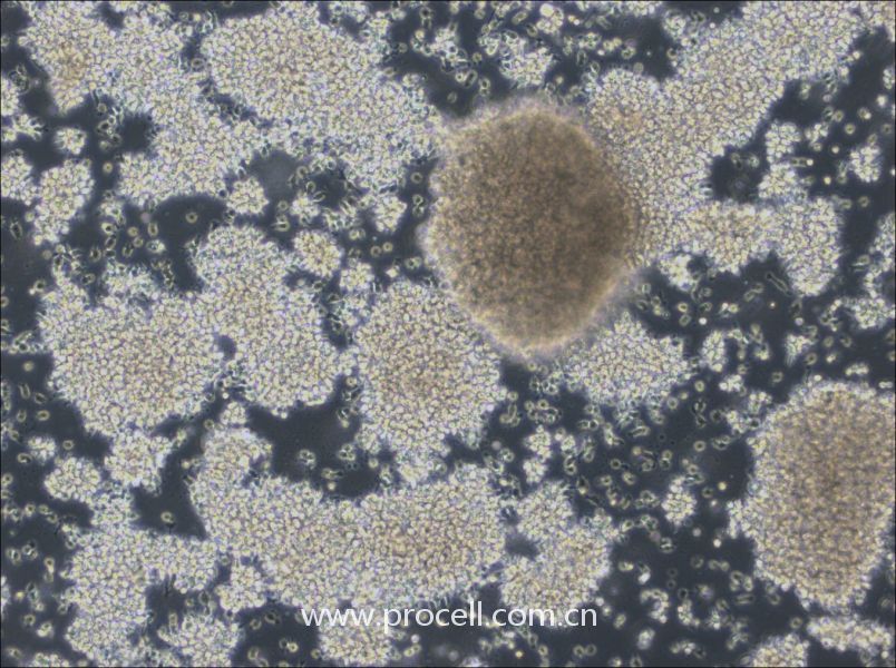 NCI-BL2009 (人淋巴母细胞（EBV 转化）) (STR鉴定正确)