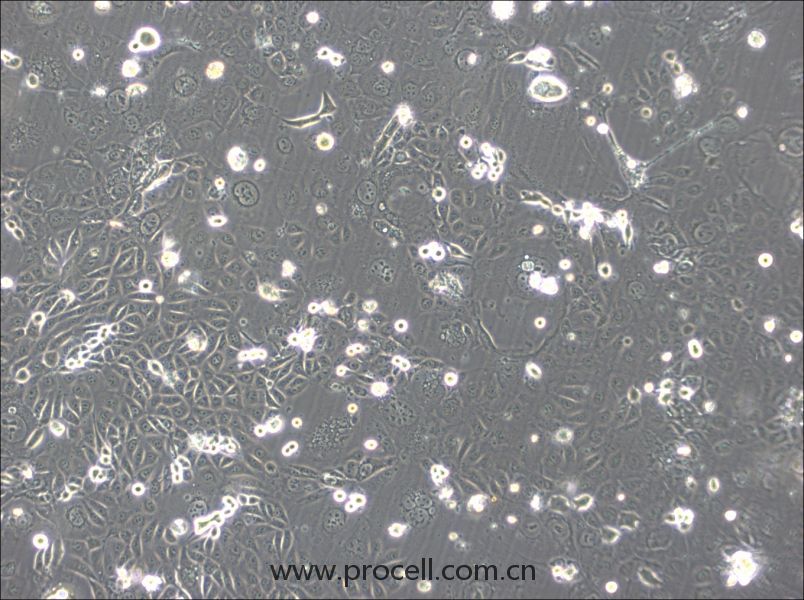 SVCT (人乳腺上皮细胞) (STR鉴定正确)