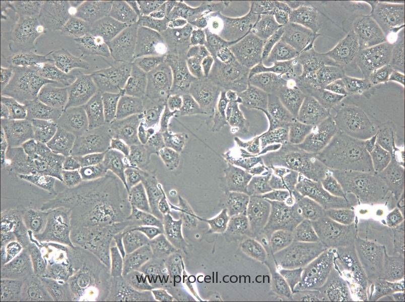 NCI-H1693 (人肺腺癌细胞) (STR鉴定正确)