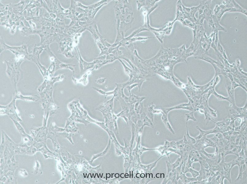 HLE-B3 (人晶状体上皮细胞) (STR鉴定正确)