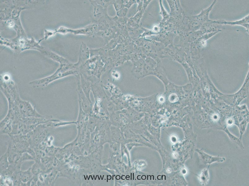 HLE-B3 (人晶状体上皮细胞) (STR鉴定正确)