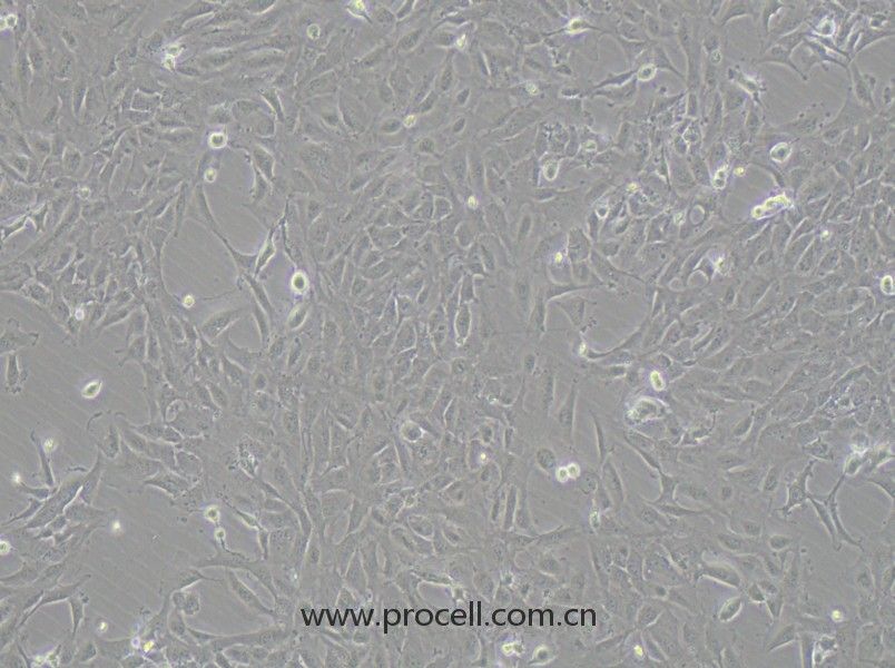 12Z (人子宫内膜异位上皮细胞永生化细胞) (STR鉴定正确)