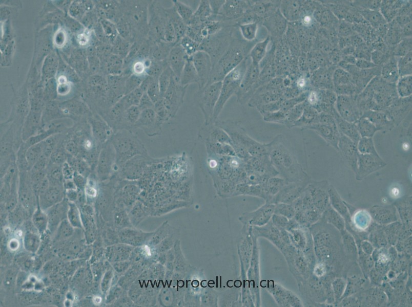 WI-38 VA-13 subline 2RA (人胚肺细胞SV40转化肺成纤维细胞) (STR鉴定正确)