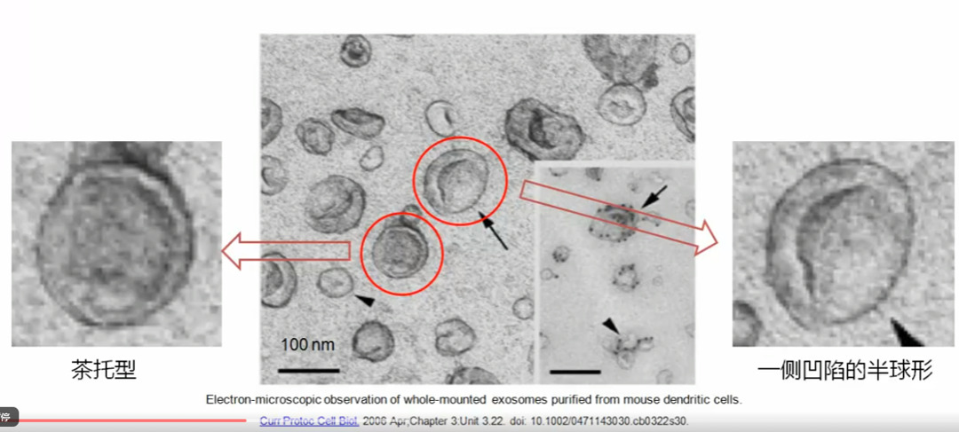 电镜下的外泌体结构
