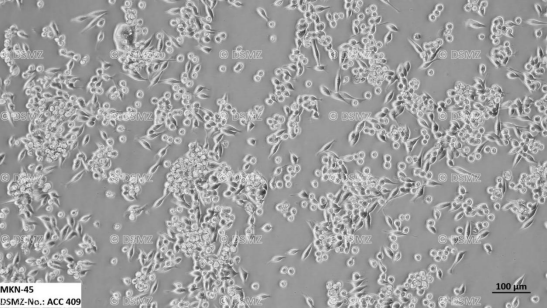MKN-45细胞显微镜图