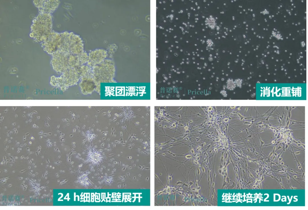 大鼠背根神经元细胞常温运输后的聚团处理