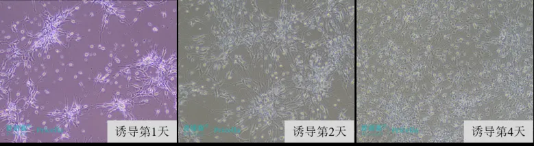 神经干细胞诱导分化为星形胶质细胞的形态变化