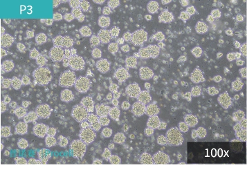 Neural-Stem- Cells7.jpg