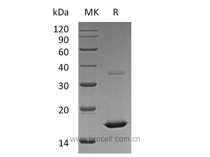 Procell-FGF-2/ bFGF/ FGF-b (Met134-Ser288), Human, Recombinant