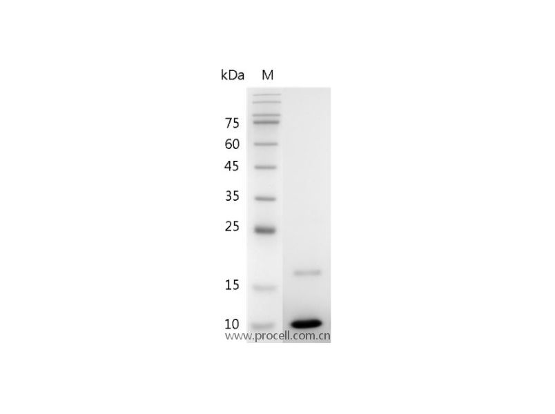 IGF-I/Somatamedin C/IGF-IA, Mouse, Recombinant