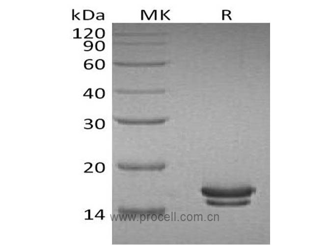 IL-2 (C-6His), Rat, Recombinant