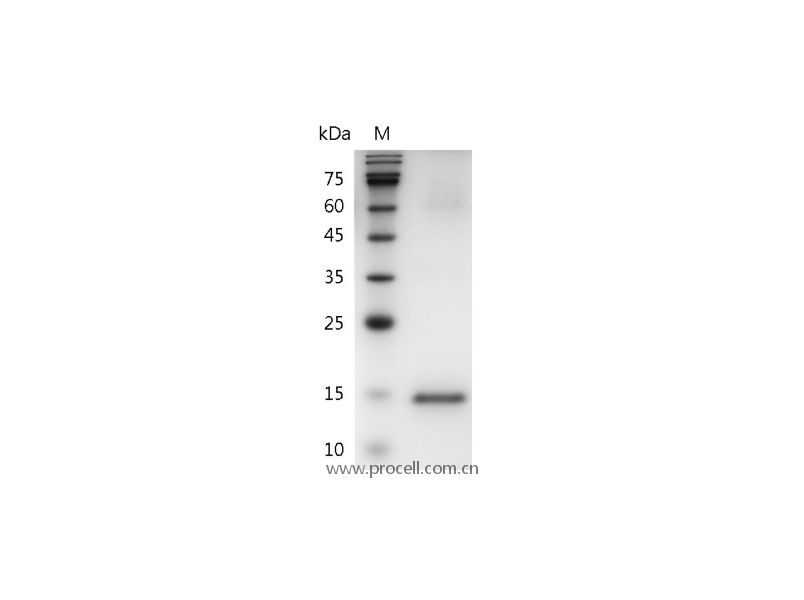 GM-CSF/CSF2/CSF, Human, Recombinant