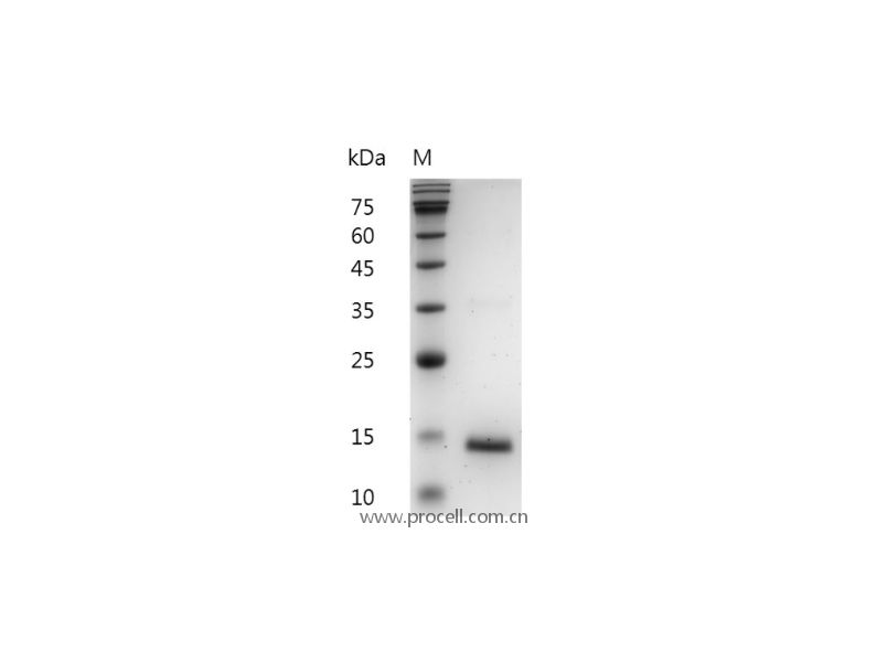 GM-CSF/CSF2/MGI-I/MGI-IGM, Mouse, Recombinant