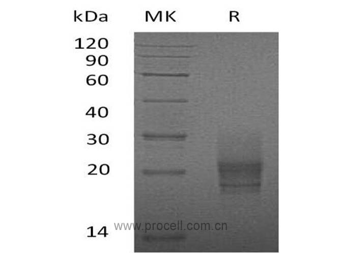 GM-CSF/ CSF2 (C-6His), Mouse, Recombinant