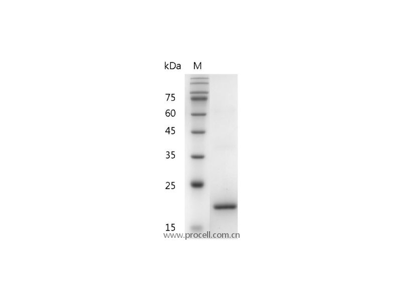 G-CSF/CSF-3/MGI-1G, Human, Recombinant