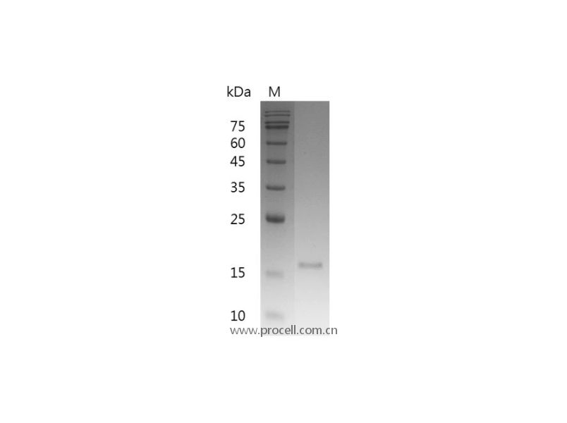 RANKL/TNFSF11/TRANCE/CD254, Mouse, Recombinant