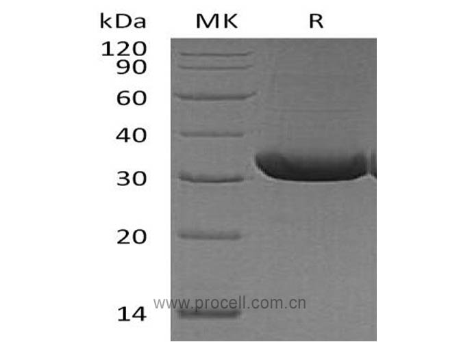 RANK L/ TRANCE/ TNFSF11 (N-6His), Mouse, Recombinant