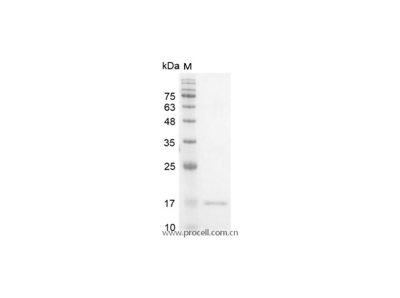 Interferon γ/IFN-γ/IFNG, Human, Recombinant