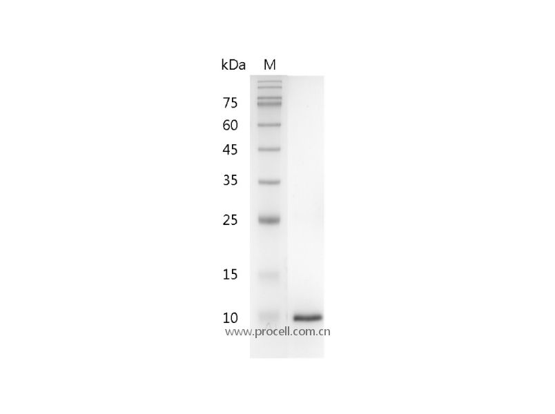 β-NGF/NGF/NGFB/NGF-β, Mouse, Recombinant