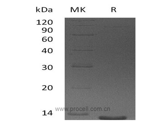 Eotaxin-3/ CCL26 (24-94), Human, Recombinant