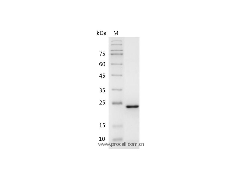 FGF-21/FGFL, Human, Recombinant