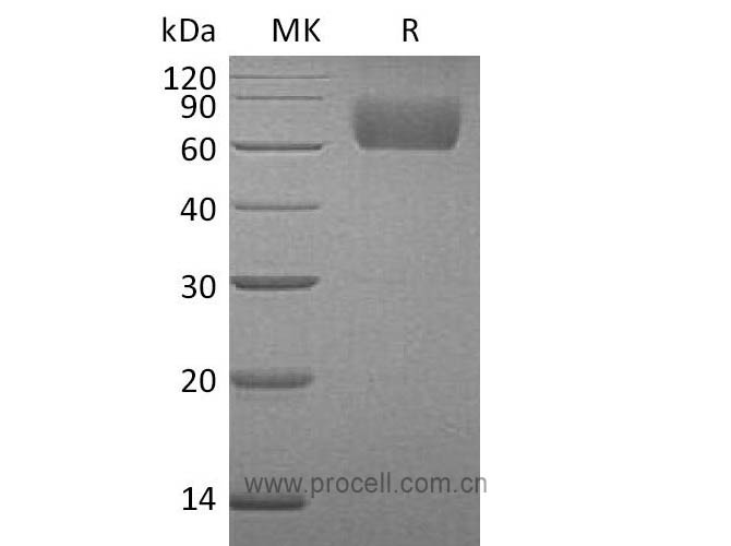 FGFR-3/ CD333/ FGFR3, Human, Recombinant