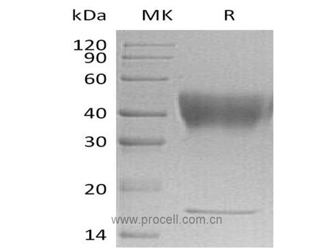 IFNGR1/ CD119, Human, Recombinant