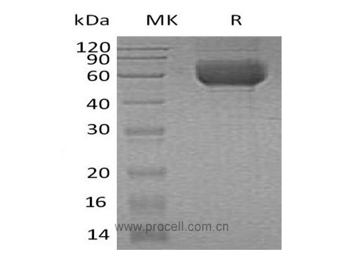 ST2/ IL1RL1, Human, Recombinant