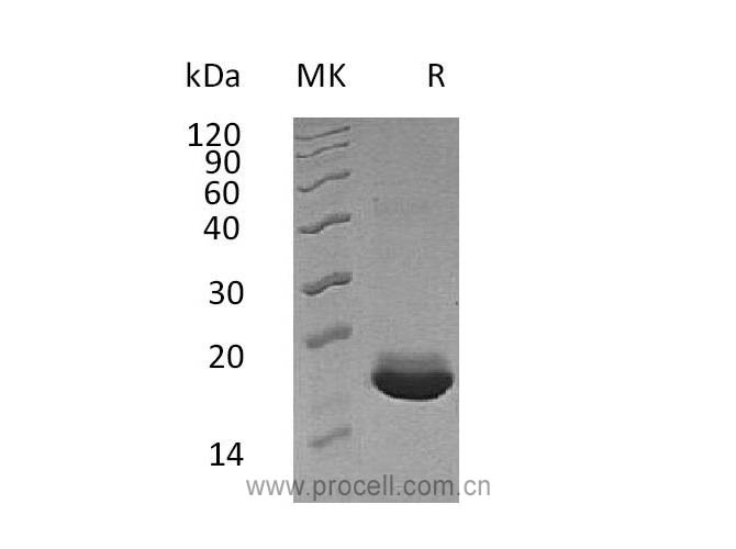 MANF/ ARMET/ ARP (C-6His), Human, Recombinant