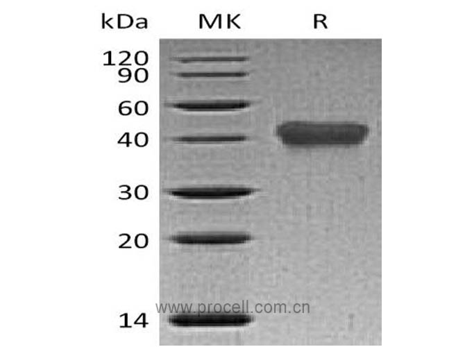 TNFR2/ TNFRSF1B/ CD120b (C-6His), Human, Recombinant