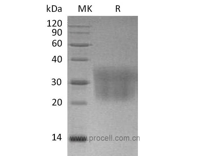 Procell-MCP-1/ CCL2 (C-6His), Mouse, Recombinant