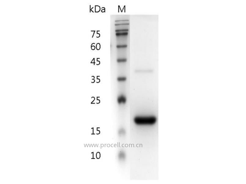 IFNβ 1a/IFNB1, Human, Recombinant