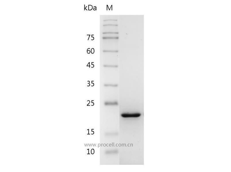 4-1BBL/TNFSF9, Human, Recombinant