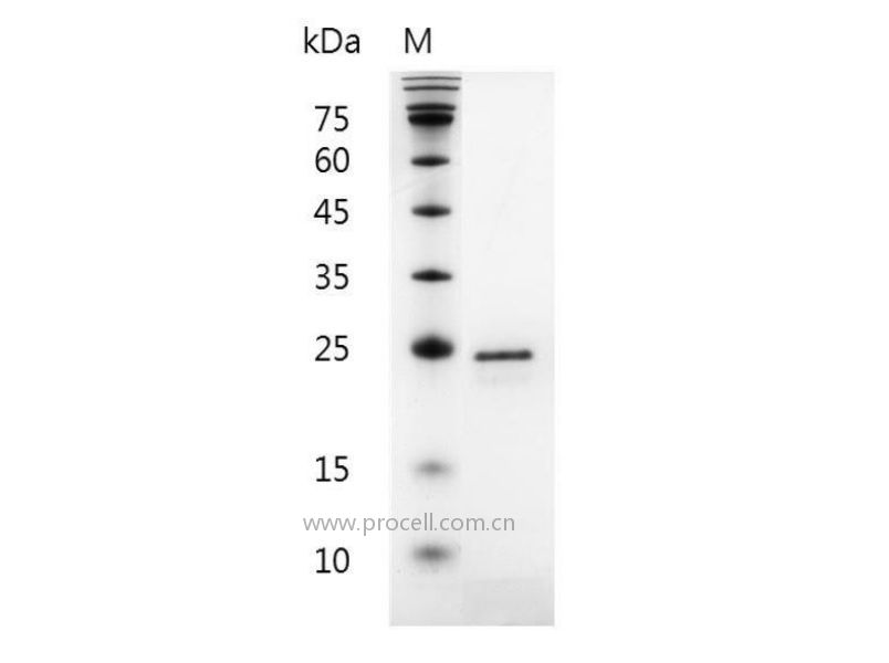 FGF-20/FGFK, Human, Recombinant