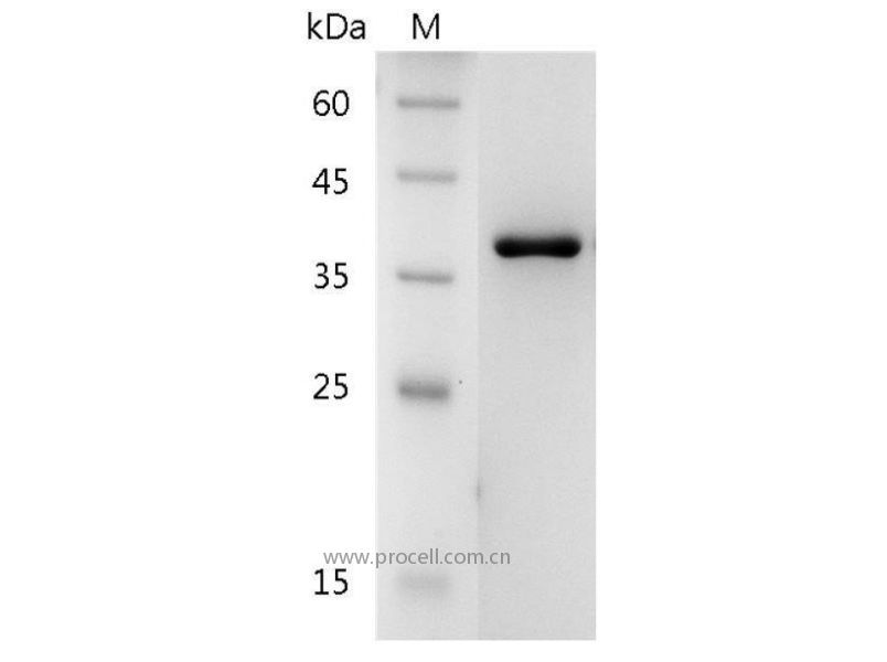 Galectin-8/LGALS8/PCTA-1/Po66-CBP, Human, Recombinant