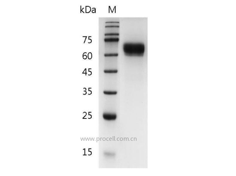 IL-12/NKSF/CLMF/TSF, Human, Recombinant