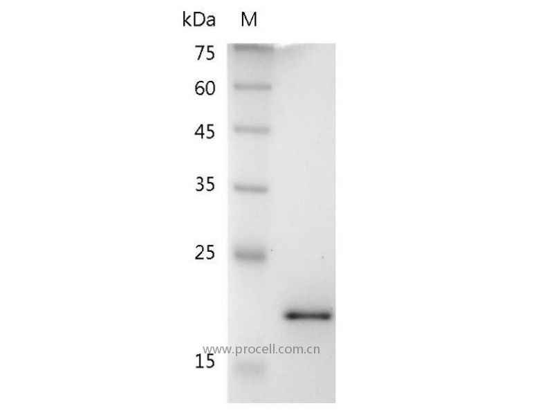 TRAIL/TNFSF10/TL2/Apo2L/CD253, Mouse, Recombinant